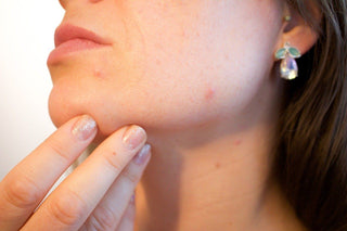 The Culprit Behind Most Skin Infections and What to Do About It